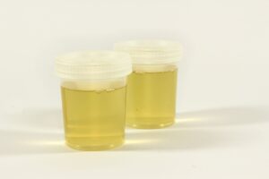 Urine Kept Warm For Drug Test